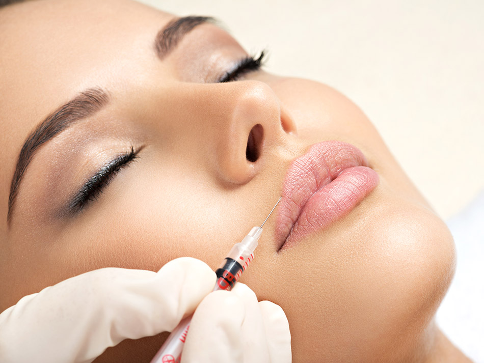 aumento-de-labios-sevilla-con-acido-hialuronico-dra-yasmin-al-adib aumento-de-labios-sevilla-con-acido-hialuronico-dra-yasmin-al-adib