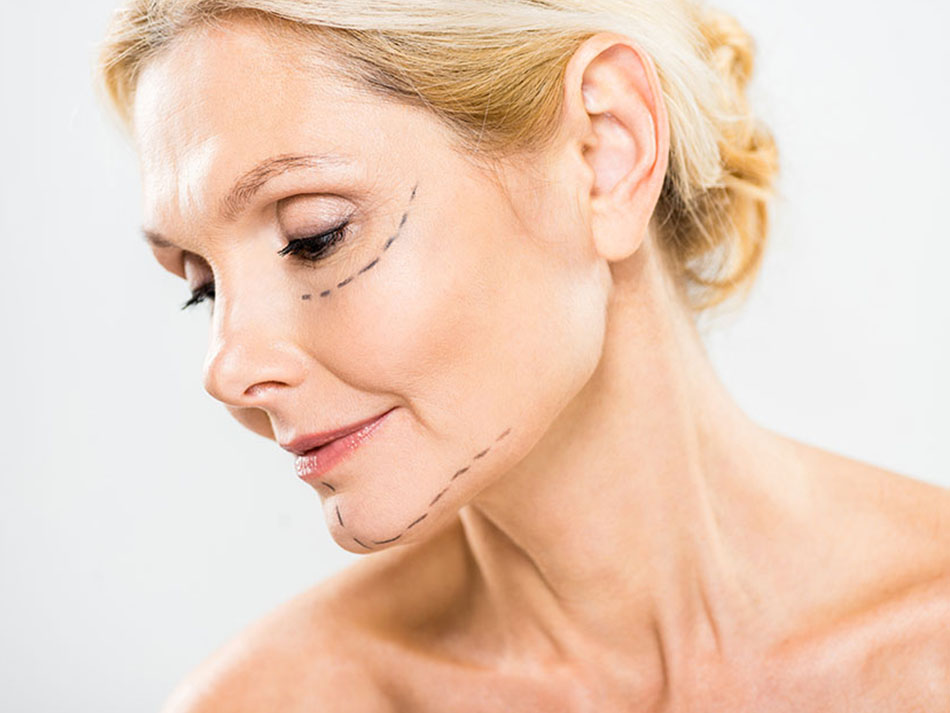 lifting-facial-sin-cirugia-ibiza-yasmin-al-adib lifting-facial-sin-cirugia-ibiza-yasmin-al-adib
